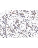 Anti-FGF-4 Antibody, Rabbit Polyclonal sinobiological 16043-T08