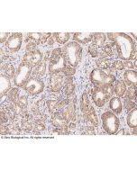 Anti-ACP6 Antibody, Rabbit Polyclonal sinobiological 102753-T08