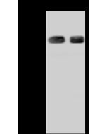 Anti-CASP8/ALPS2B Antibody, Rabbit Polyclonal sinobiological 203543-T44