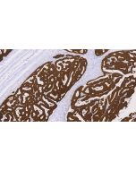 Anti-Human CK8/Cytokeratin 8 Antibody, Mouse MAb sinobiological IHC027