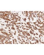 Anti-keratin 76/KRT76 Antibody, Rabbit Polyclonal sinobiological 104712-T08