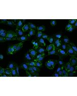 Anti-FAM198A Antibody, Rabbit Polyclonal sinobiological 206459-T02