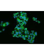 Anti-Fetuin A/FETUA Antibody, Rabbit Polyclonal sinobiological 205452-T02