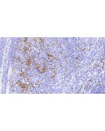 Anti-Human MUM1 Antibody, Mouse MAb sinobiological IHC050