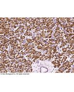 Anti-FGFR1 Antibody, Mouse Monoclonal sinobiological 10616-MM09