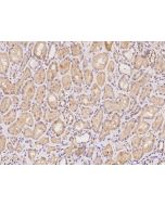 Anti-BEND4 Antibody, Rabbit Polyclonal sinobiological 204527-T08