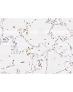 Anti-IL-1 beta Antibody, Mouse Monoclonal sinobiological 10139-MM39