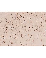 Anti-HNRNPA1 Antibody, Rabbit Polyclonal sinobiological 203742-T08