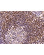 Anti-ABI3 Antibody, Rabbit Polyclonal sinobiological 202331-T08