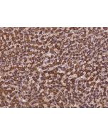 Anti-HOGA1 Antibody, Rabbit Polyclonal sinobiological 201766-T08