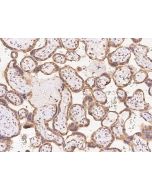Anti-FAM206A Antibody, Rabbit Polyclonal sinobiological 204585-T08