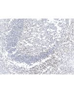 Anti-CD4 Antibody, Rabbit Polyclonal sinobiological 10400-T24