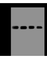 Anti-CAPZA2 Antibody, Rabbit Polyclonal sinobiological 200726-T36