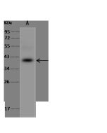 Anti-BRIX1/BXDC2 Antibody, Rabbit Polyclonal sinobiological 201598-T34