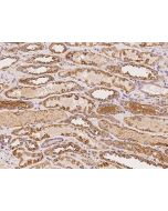 Anti-ASTL Antibody, Rabbit Polyclonal sinobiological 204690-T08