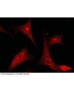 Anti-GSTP1/GST3 Antibody, Rabbit Polyclonal sinobiological 100926-T38