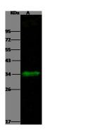 Recombinant Anti-Carbonic Anhydrase XIV/CA14 Antibody, Rabbit Monoclonal sinobiological 10458-R004