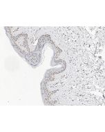 Anti-KANSL2 Antibody, Rabbit Polyclonal sinobiological 204028-T08