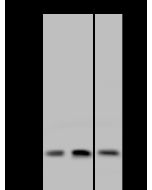 Anti-DCTN3 Antibody, Rabbit Polyclonal sinobiological 203731-T44
