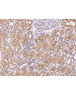 Anti-C6orf47 Antibody, Rabbit Polyclonal sinobiological 204511-T08