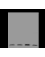 Anti-FIS1/TTC11 Antibody, Rabbit Polyclonal sinobiological 200349-T44