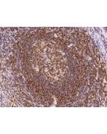 Anti-ARHGEF1 Antibody, Rabbit Polyclonal sinobiological 205323-T10
