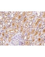 Anti-FGF5 Antibody, Rabbit Polyclonal sinobiological 100917-T08