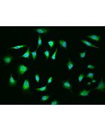 Anti-MGA Antibody, Rabbit Polyclonal sinobiological 204773-T02