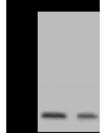 Anti-CGGBP1 Antibody, Rabbit Polyclonal sinobiological 201340-T34