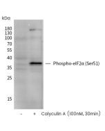 Phospho-eIF2α (Ser51) Antibody, Rabbit PAb, Antigen Affinity Purified sinobiological 110457-T32