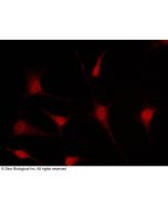 Anti-Musashi 1/MSI1 Antibody, Rabbit Polyclonal sinobiological 100587-T10