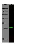 Recombinant Anti-Bcl-2 Antibody, Rabbit Monoclonal sinobiological 100126-R001