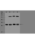 Anti-ECHS1 Antibody, Rabbit Polyclonal sinobiological 201442-T46