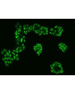 Anti-CTR9 Antibody, Rabbit Polyclonal sinobiological 201675-T02