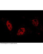 Anti-ARIH2 Antibody, Rabbit Polyclonal sinobiological 100836-T42