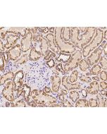 Anti-AMIGO2 Antibody, Rabbit Polyclonal sinobiological 201249-T08