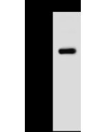 Anti-METAP1 Antibody, Rabbit Polyclonal sinobiological 10241-T48
