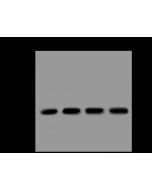 Anti-Factor B Antibody, Rabbit Polyclonal sinobiological 310736-T34