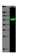 Anti-Cytokeratin 5/KRT5 Antibody, Rabbit Polyclonal sinobiological 100312-T32