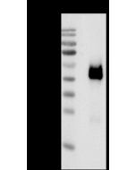 Chikungunya virus (CHIKV) (strain SL-CK1) E2 / Envelope 2 Antibody, Mouse MAb sinobiological 40440-MM26
