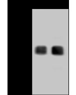 Monkeypox Virus (MPXV) B6R Antibody, Rabbit MAb sinobiological 40902-R007