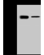 Human coronavirus (HCoV-OC43) Nucleocapsid Antibody, Rabbit PAb, Antigen Affinity Purified sinobiological 40643-T62
