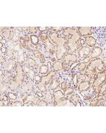 Anti-ADRA1D Antibody, Rabbit Polyclonal sinobiological 202642-T08