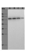 Recombinant Anti-CD5 Antibody, Rabbit Monoclonal sinobiological 11027-R505