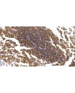 Anti-Human TdT/Terminal Deoxynucleotidyl Transferase Antibody, Mouse MAb sinobiological IHC071