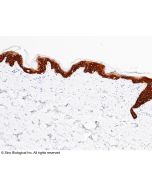 Anti-Cytokeratin 14/KRT14 Antibody, Rabbit Polyclonal sinobiological 100129-RP02