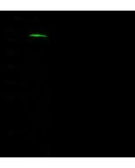 Anti-CTAGE1 Antibody, Rabbit Polyclonal sinobiological 103810-T36