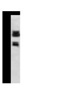 Anti-Clusterin Antibody, Rabbit Polyclonal sinobiological 11297-T34