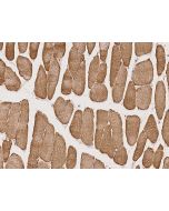 Anti-BTF3L4 Antibody, Rabbit Polyclonal sinobiological 203613-T08
