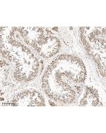 Anti-FDX1L Antibody, Rabbit Polyclonal sinobiological 207958-T08